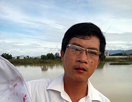 Bình Thuận: Phó Chủ tịch xã bị giám đốc doanh nghiệp đánh chảy máu